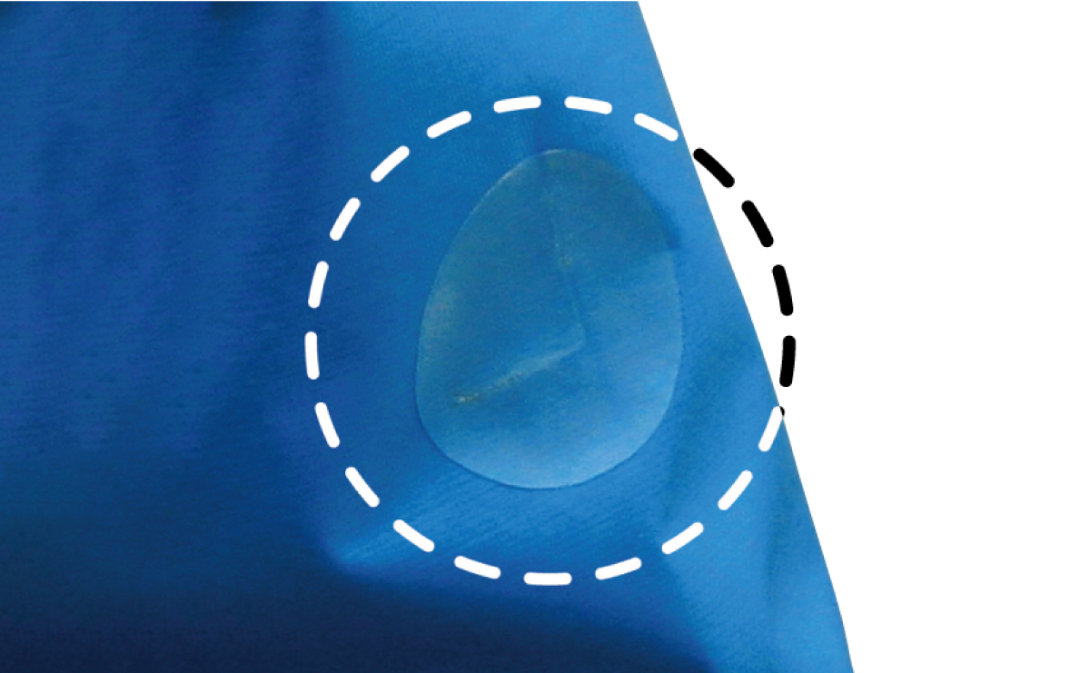 An image of a tear in rainwear repaired with a patch sheet.